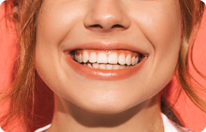 invisalign - Instituto Odonto Premium